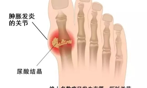 糖尿病早期什么症状可以治好吗-糖尿病人的早期治疗网—知名的糖尿病早期怎么调理能好网站,分享糖尿病早期怎么治疗可以恢复正常知识